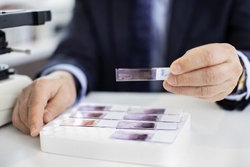 Icon operates the largest private cancer clinical trials program in Australia