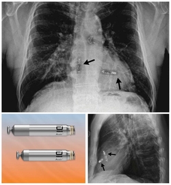 Epworth cardiologist Associate Professor Michael Wong